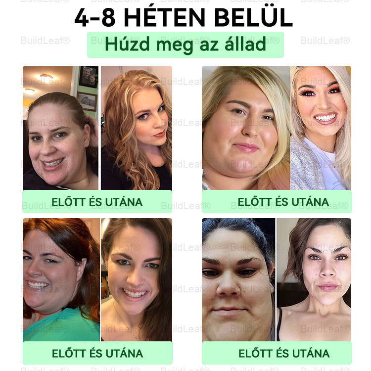 đđș MĂĄr csak 5 doboz maradt! A BuildLeafÂź đtovĂĄbbi 50% kedvezmĂ©nyt ad! ĂllĂtsd helyre a tested Ă©s az egĂ©szsĂ©ged. HasznĂĄld ki most, kĂ©sĆbb mĂĄr nem lesz rĂĄ lehetĆsĂ©ged.