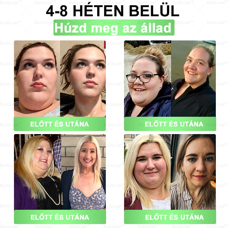 Hivatalos zászlóshajó üzlet | BuildLeaf® szájüregi oldat (naponta egyszer, hét nap alatt eredmény) ✅ Támogatja a testsúly szabályozását, a szív egészségét, a cukorbetegség kezelését, a bél egészségét és a nők jóllétét.