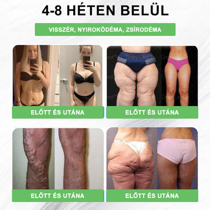 🥝𝐓𝐞𝐥𝐣𝐞𝐬 𝐭𝐞𝐬𝐭 𝐞𝐠é𝐬𝐳𝐡𝐞𝐠é𝐠𝐞 𝐢𝐭𝐭 𝐤𝐞𝐳𝐝ő𝐝𝐢𝐤 ✅ 𝐂𝐫𝐚𝐳𝐲𝐋𝐞𝐚𝐟® 𝐆𝐋𝐏-𝟏 𝐌𝐎𝐑𝐈𝐍𝐆𝐀 𝐅𝐨𝐠𝐲ó𝐤ú𝐫á𝐬 🛡️ & 𝐄𝐠é𝐬𝐳𝐡𝐞𝐠𝐟𝐨𝐤𝐨𝐳ó 𝐂𝐬𝐞𝐩𝐩𝐞𝐤 💪 – Magas vérnyomás, pajzsmirigy alulműködés, magas vércukor, elhízás, bőr feszesítése