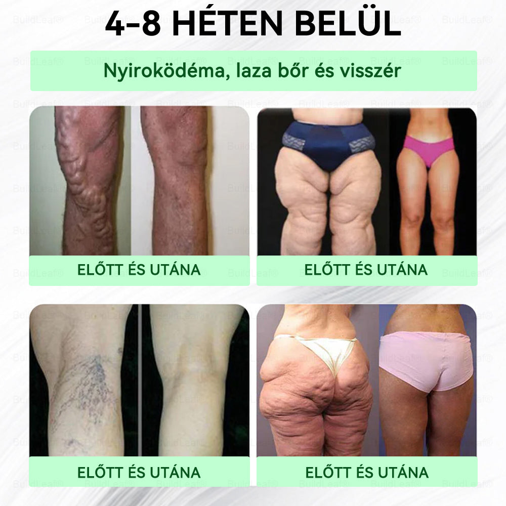 Hivatalos áruház 🏥 | BuildLeaf® GLP-1 Nano-Mikrotűs Tapasz Kollagénnel és Matrixyl 3000-rel丨Elhízás, Szív- és Érrendszeri Betegségek, Cukorbetegség, Alvási Apnoe, Ízületi Problémák és Egyéb Gondok Esetén