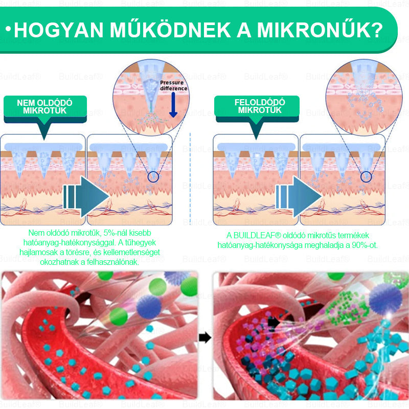 Hivatalos áruház 🏥 | BuildLeaf® GLP-1 Nano-Mikrotűs Tapasz Kollagénnel és Matrixyl 3000-rel丨Elhízás, Szív- és Érrendszeri Betegségek, Cukorbetegség, Alvási Apnoe, Ízületi Problémák és Egyéb Gondok Esetén